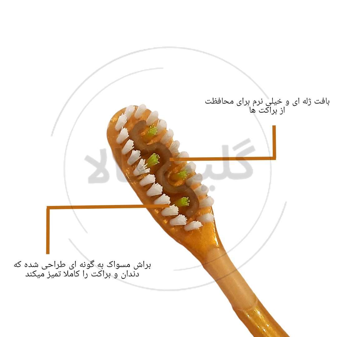  مسواک مخصوص ارتودنسی 