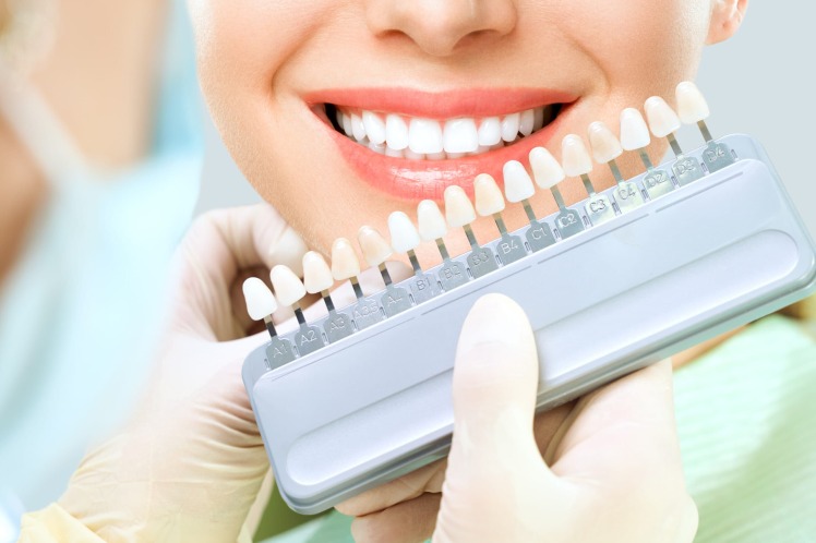 ویژگی های خمیردندان مناسب کامپوزیت